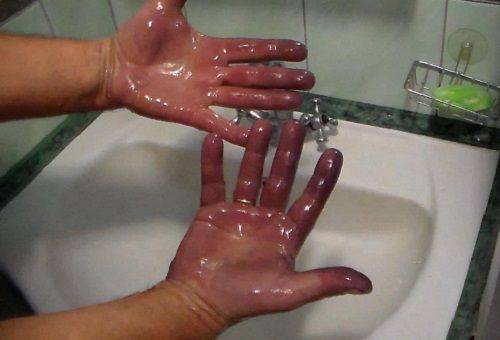 žalių riešutų dėmių pašalinimas