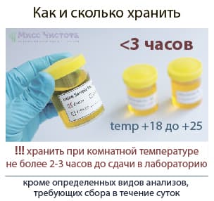 Kiek laiko laikyti šlapimą patikimai analizei atlikti?
