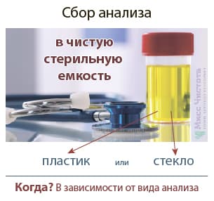 Šlapimo tyrimo surinkimas