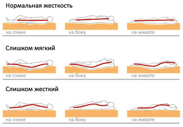 Taisyklinga kūno padėtis miegant